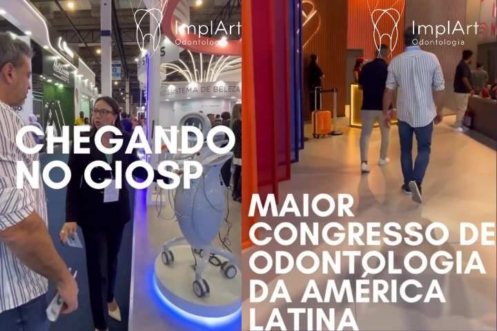 Últimas Inovações em Implantes Dentários - Clínica ImplArt no Maior Evento de Odontologia da América Latina Inovações em Implantes Dentários