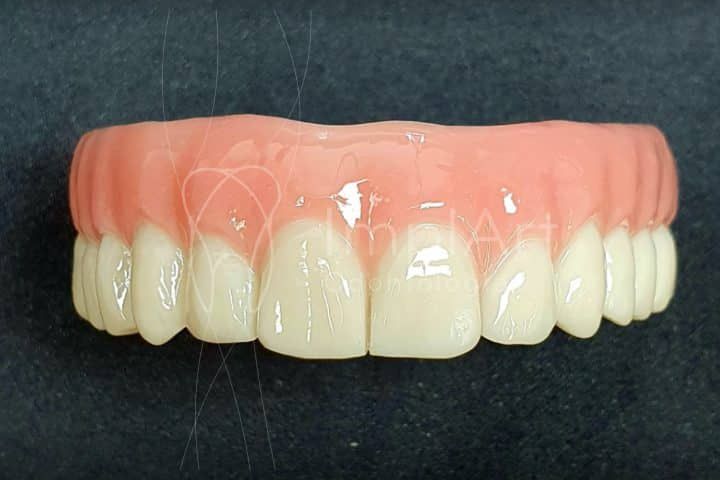 Zircônia nas próteses protocolo Branemark protese protocolo