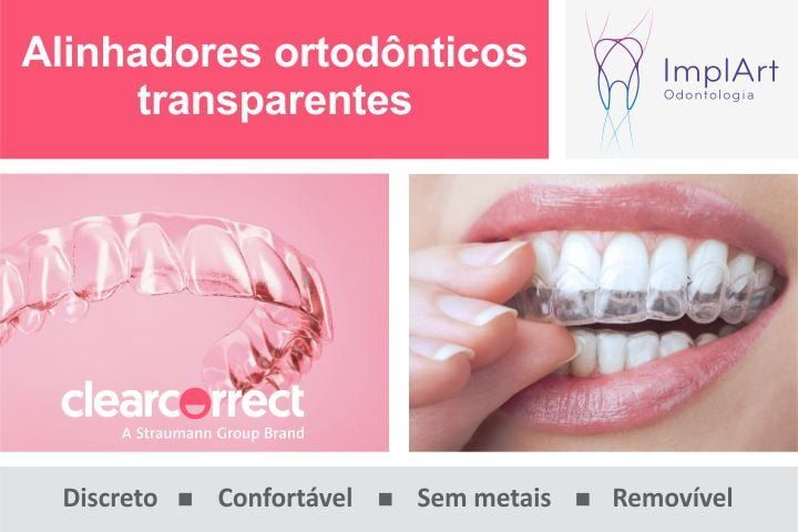 Straumann ClearCorrect: alinhadores transparentes para corrigir os dentes clearcorrect