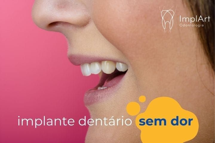Implante Dentário Sem Dor: Tecnologia Permite mais Conforto para sua Cirurgia de Implante implante dentario sem dor