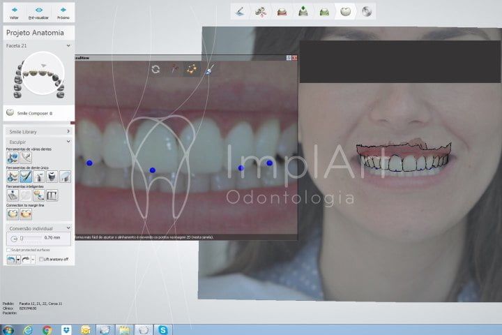 Visagismo na odontologia - harmonia entre face e dentes Visagismo