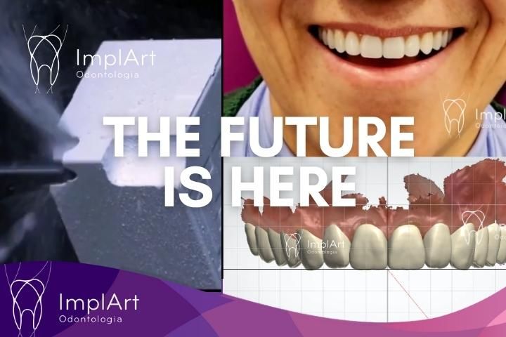 Planejamento Digital do Sorriso com Inteligência Artificial: O Futuro do seu Sorriso na Clínica ImplArt Digital Smile Design