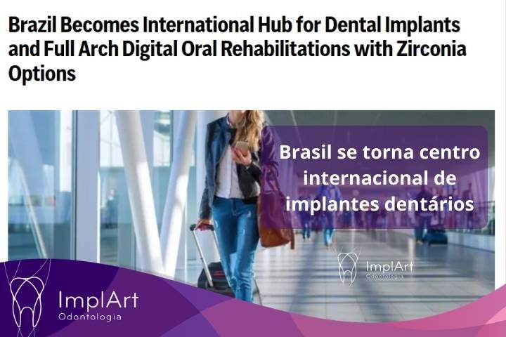 Clínica ImplArt destino internacional para quem procura implante dentário no Brasil e reabilitação oral digital implante dentario no Brasil