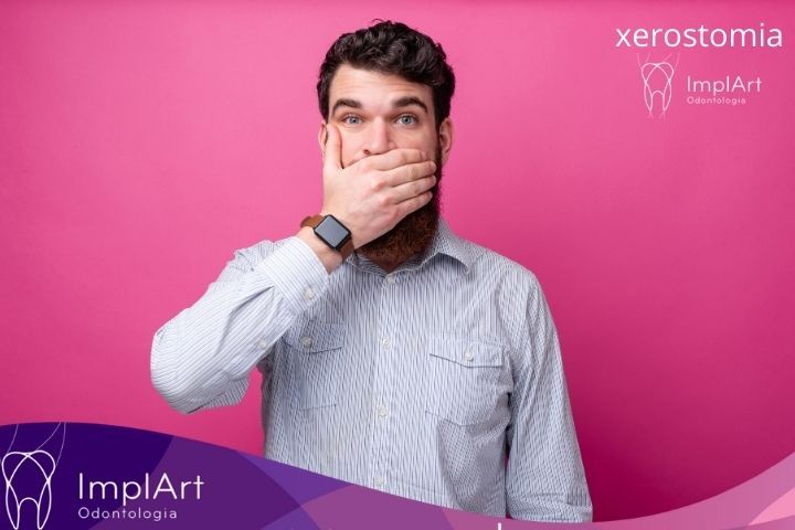 Boca seca e consequências para a saúde bucal: Xerostomia xerostomia - boca seca