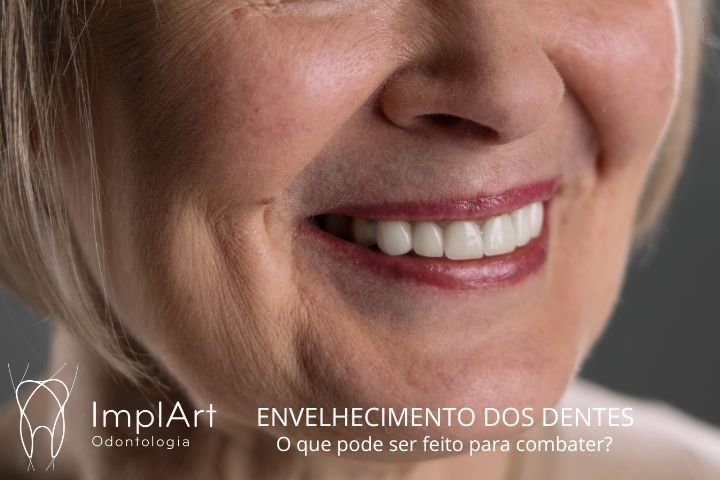 Envelhecimento dos dentes: como ocorre e como se prevenir? envelhecimento dos dentes