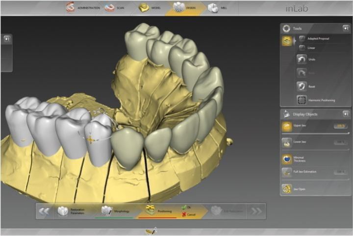 COROA DENTARIA 3D CAD/CAM - prótese digital automatizada em São Paulo coroa dentaria 3D