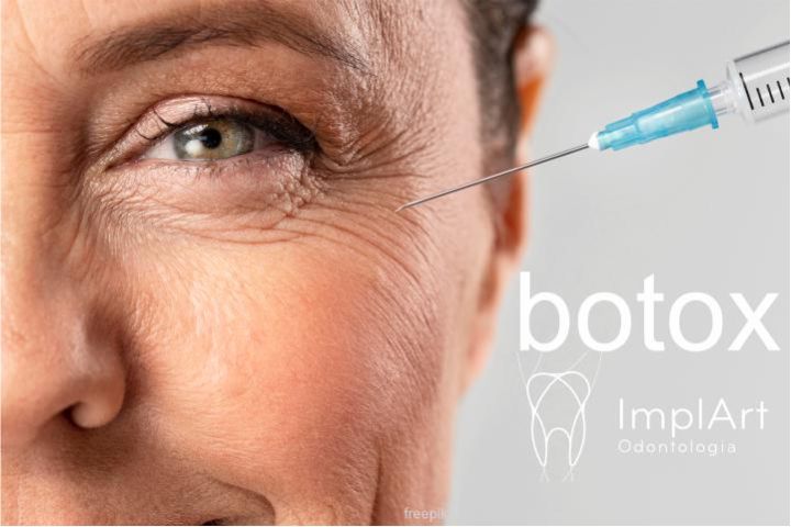 Toxina botulínica para fins terapêuticos odontológicos TOXINA BOTULINICA