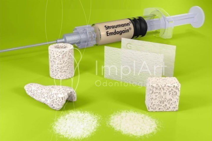 Enxerto em bloco x enxerto em pó (particulado) enxerto em pó