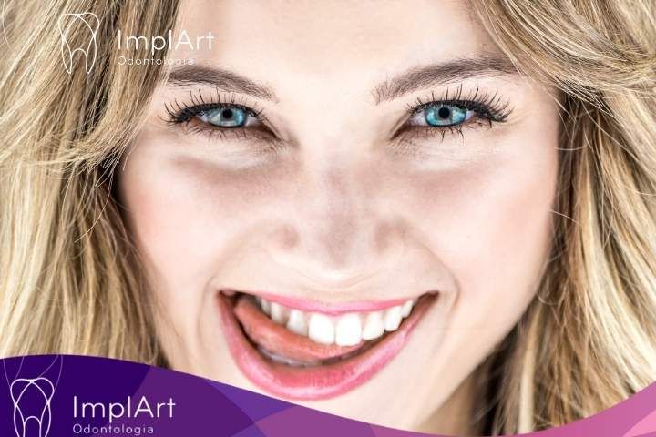 Mewing: Técnicas e Benefícios para a Saúde Oral e Facial MEWING