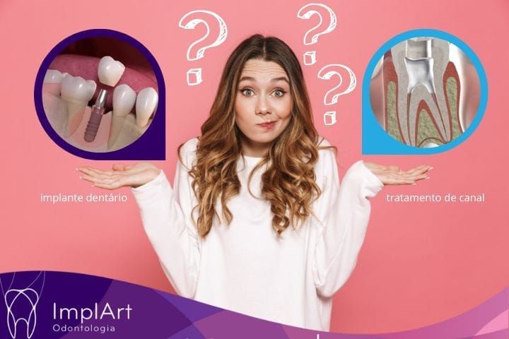 Root Canal or Dental Implant treatment? root canal or dental implant treatment