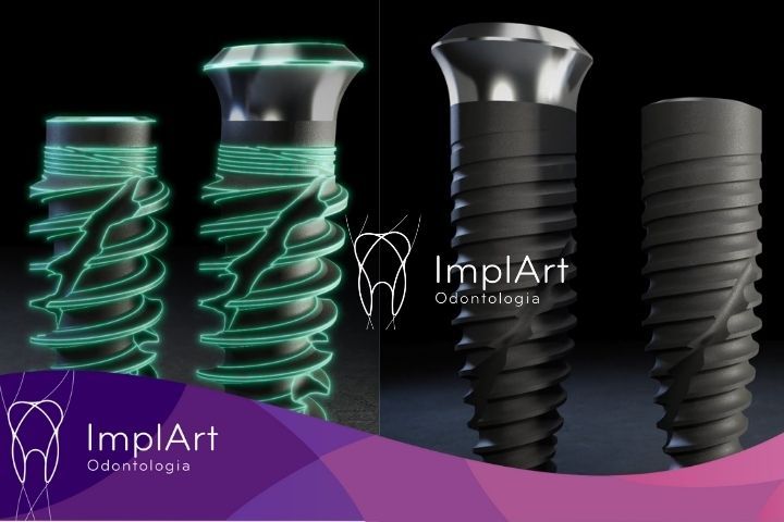 Dental implants in one day with Straumann SLActive implante total em 1 mês