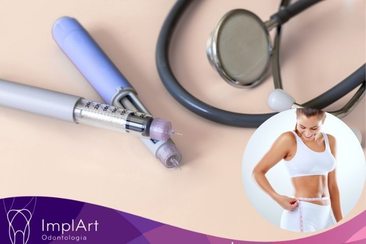 Ozempic e implante dentário: o que você precisa saber antes do tratamento ozempic e implante dentario