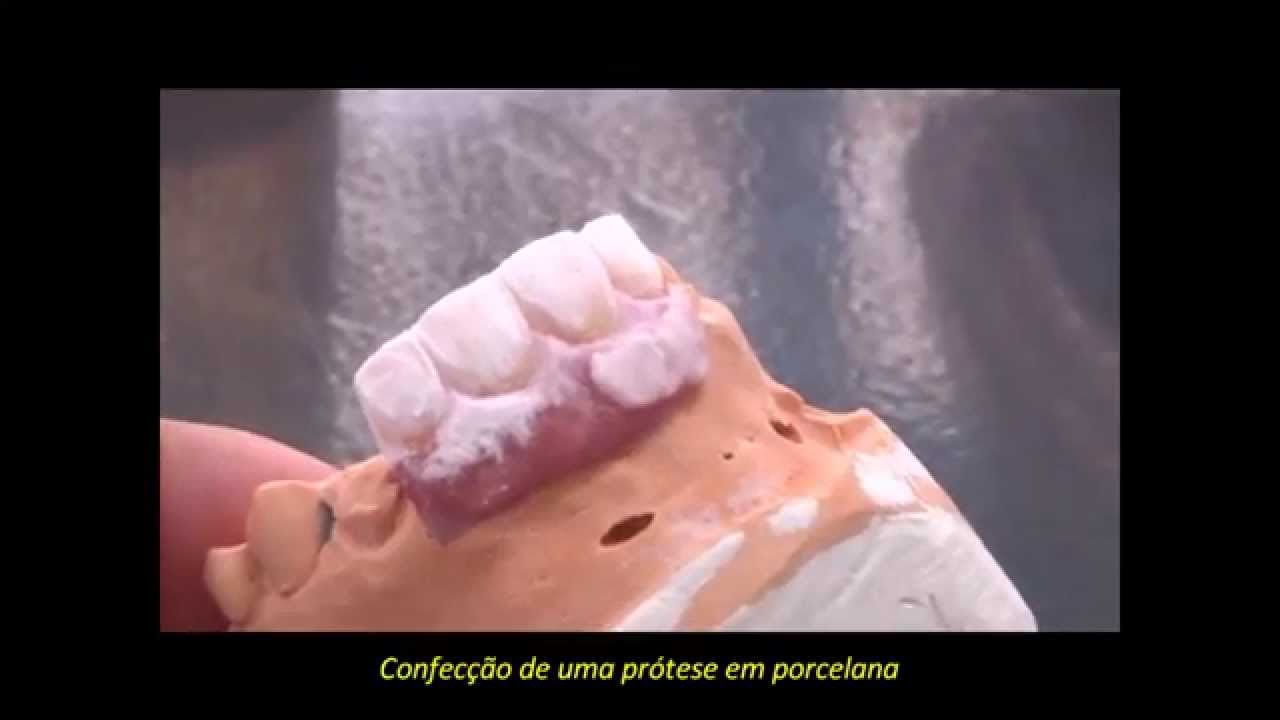 Laboratório de Prótese Dentária Dentro da Clínica ImplArt em São Paulo