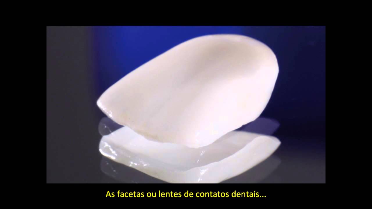 CEREC 3D - Scanner Intra Oral - ImplArt Odontologia