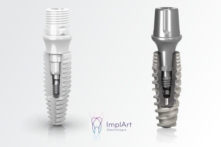 Qual a diferença entre implante cerâmico e o implante dentario de titânio? implante cerâmico