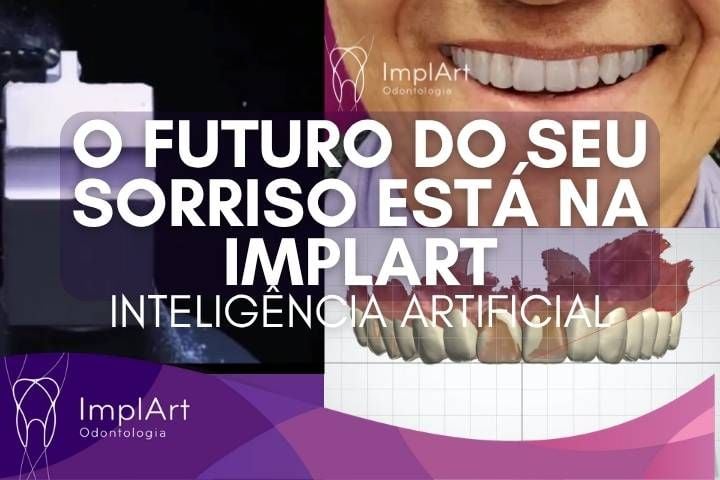 revolução na odontologia está na implart dr. roberto markarian
