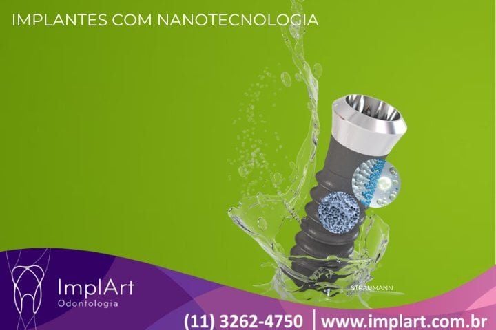 IMPLANTES COM NANOTECNOLOGIA - novos tipos de implantes dentarios IMPLANTES COM NANOTECNOLOGIA