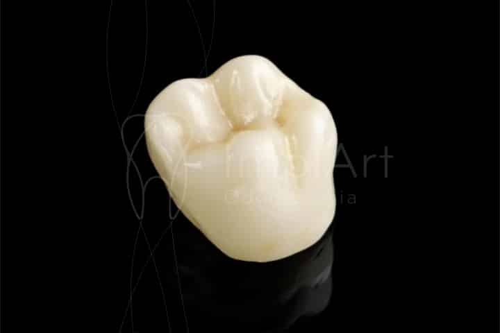 coroa dental de porcelana