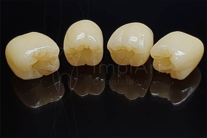 coroas zirconia zolid 50kb