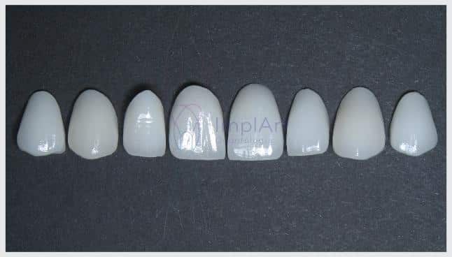 conjunto de lentes de contato dental de porcelana