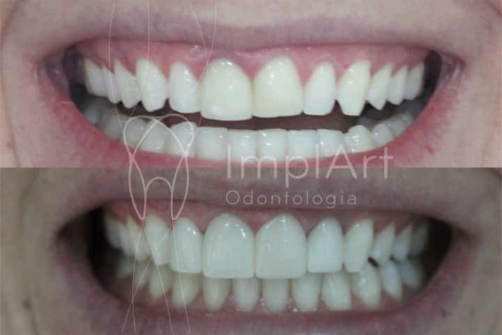 dia da noiva dental odontologico