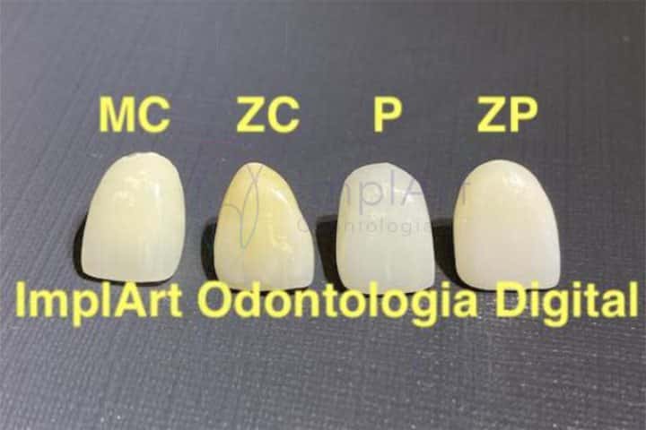 materiais coroas dentarias 47kb