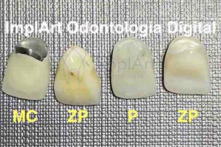 materiais coroas dentarias 48kb