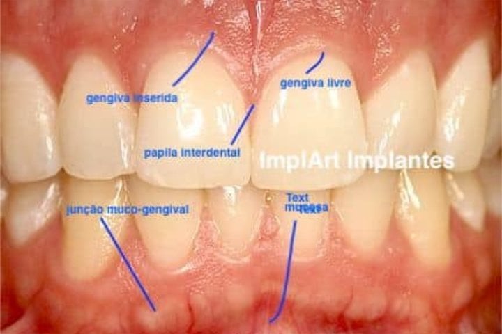 gengiva saudavel retracao 50kb