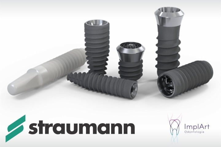 melhores implantes straumann 49kb