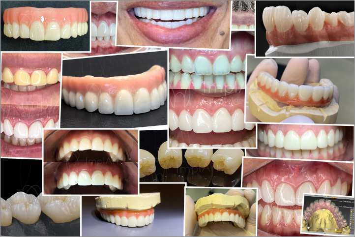 fotos de tratamentos na Clínica Odontológica ImplArt