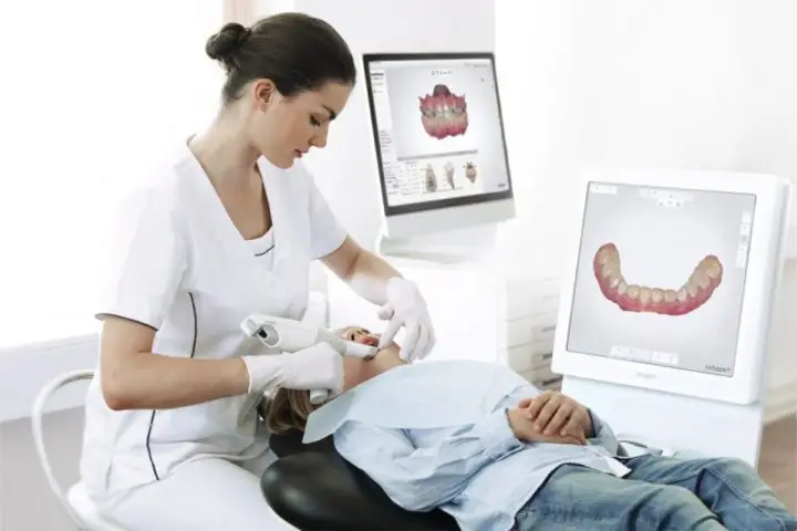 escaneamento digital dentes moldagem digital