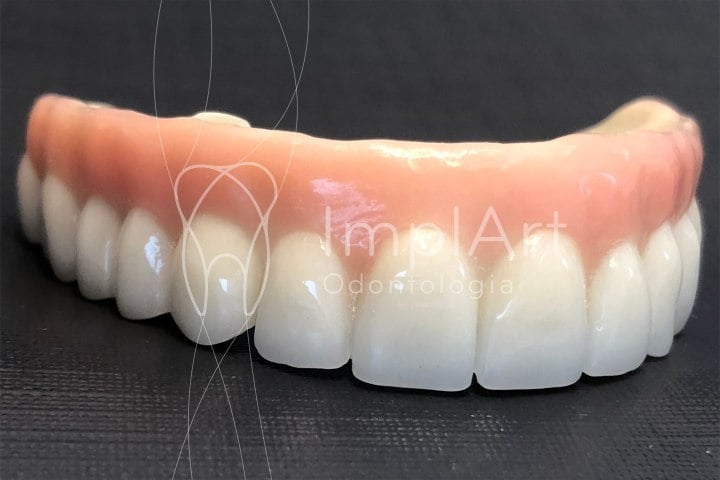 protese zirconia implart 49kb