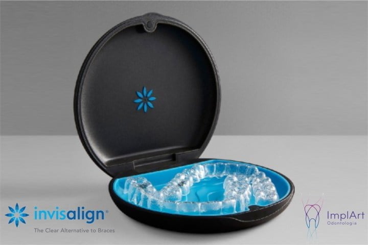 Invisalign implart alinhador transparente 50kb 1