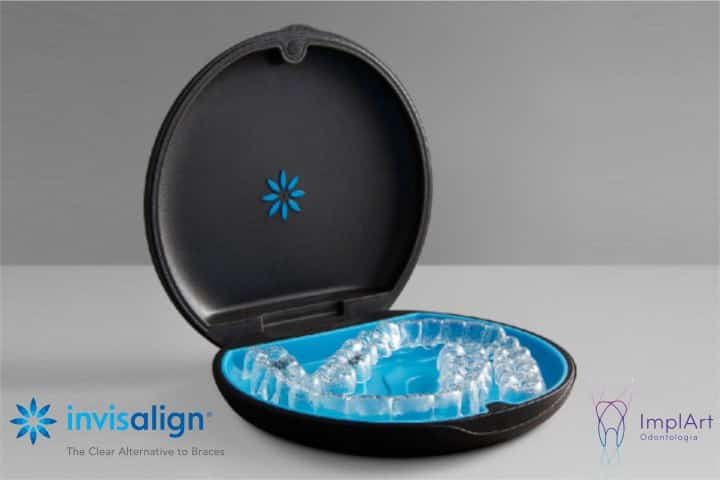 Invisalign implart alinhador transparente 50kb