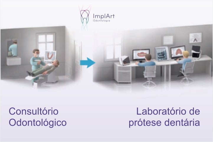 Clinica ImplArt adquire nova tecnologia em escaneamento intraoral 2 comunicacao clinica laboratorio scan 50kb