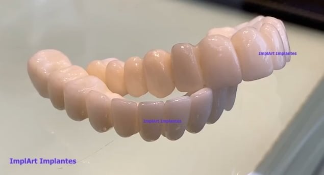 prótese dentária fixa de zirconia