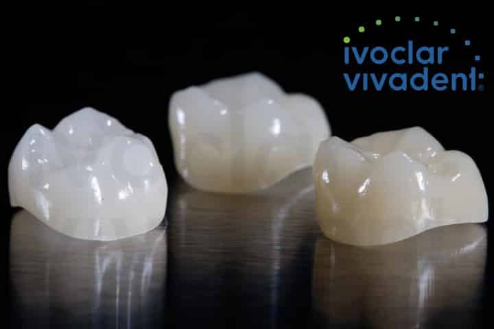 coroas de emax cerec implart