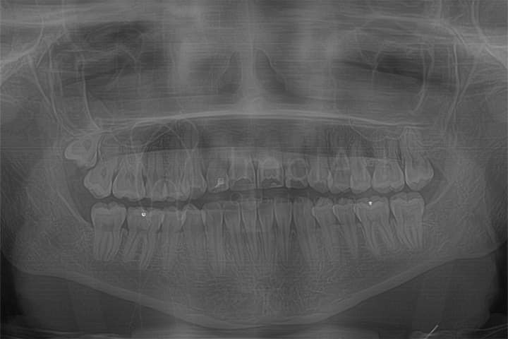 radiografia panoramica 50kb