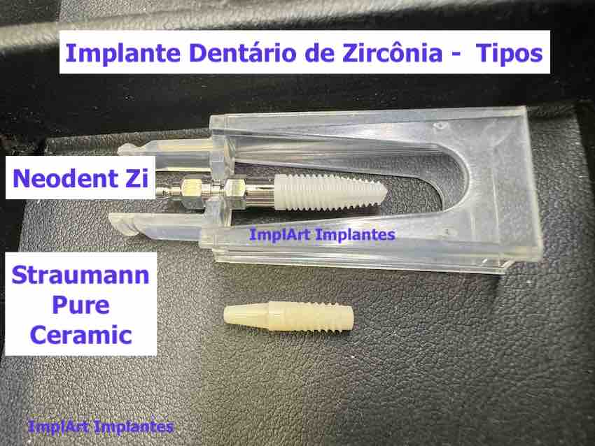 implante de zirconia straumann pure neodent zi 2