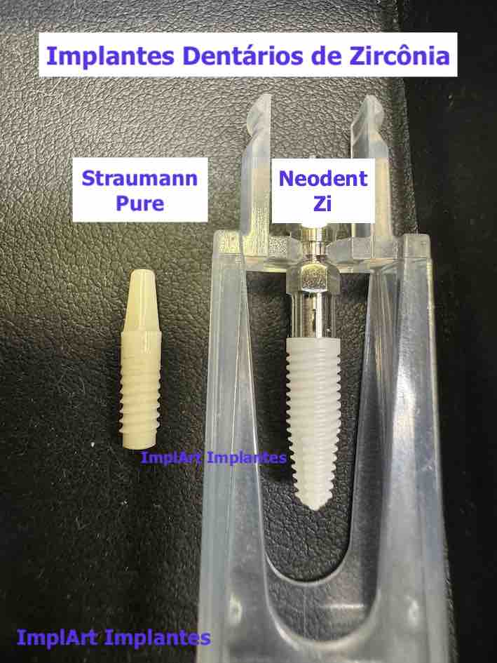 implante de zirconia straumann pure neodent zi