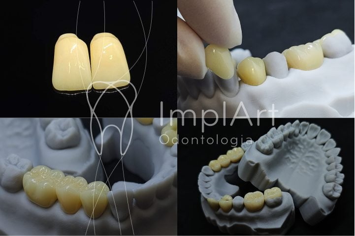 impressora 3d ultracraft chairside 42kb