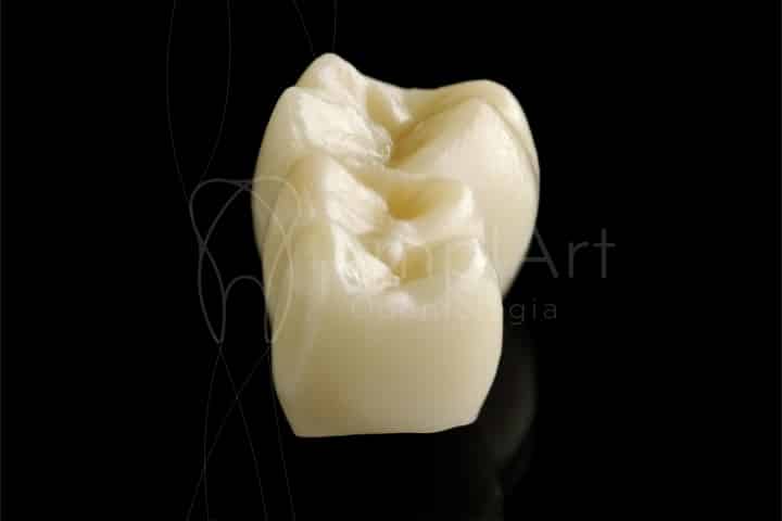 ponte dentaria zirconia 49kb