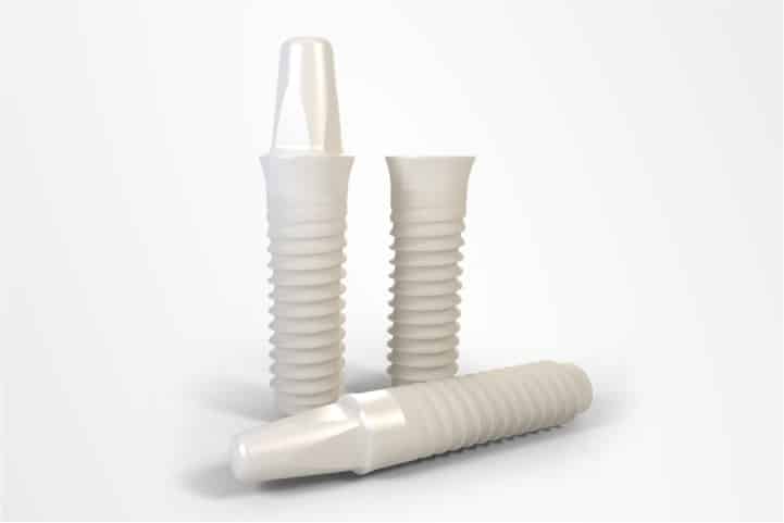 implante dentario branco de ceramica