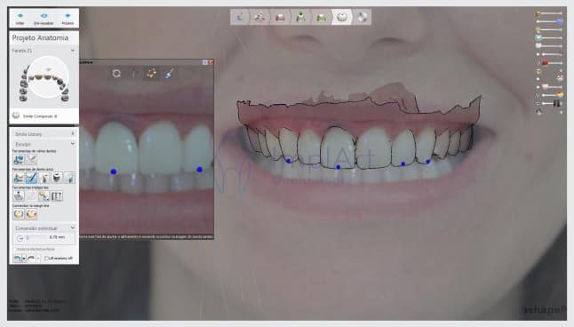 planejamento computadorizado de tratamento odontológico planejamento digital do sorriso