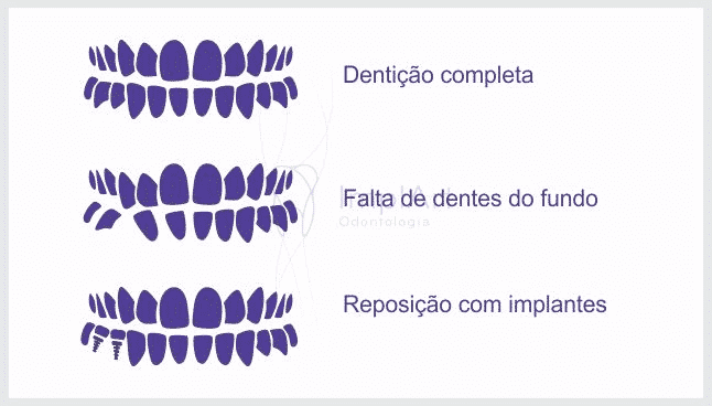 denticao 50kb