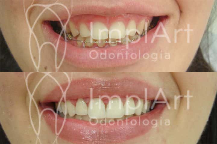 CUIDADOS BUCAIS e DENTES LINDOS PARA DIA do casamento