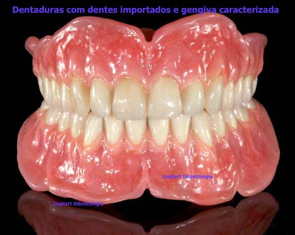 dente importado para prótese dentária