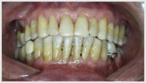 periodontia