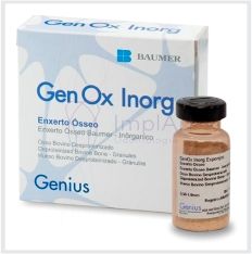 genox enxerto osseo 1