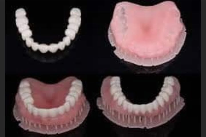 Novas impressoras 3D de dentes na ImplArt 2 Dentaduras Impressas em 3D 50kb